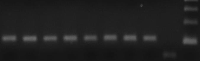 Στήλη 9: αντίδραση χωρίς υπόστρωµα (αρνητικός µάρτυρας). Στήλη 10: 100bp DNA ladder (δείκτης µεγέθους DNA).
