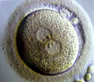 Ασθενείς και Μέθοδοι ΙΙ Εξαρτημένες μεταβλητές: ποσοστό γέννησης ζώντων νεογνών Εμβρυολογικές και κλινικές παράμετροι: (Ληφθέντα ωάρια, γονιμοποιημένα ωάρια