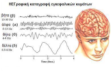 υποθερμία [43] Εικόνα 4. Ηλεκτροεγκεφαλογράφημα και καταγραφή εγκεφαλικών κυμάτων (www.sites.google.