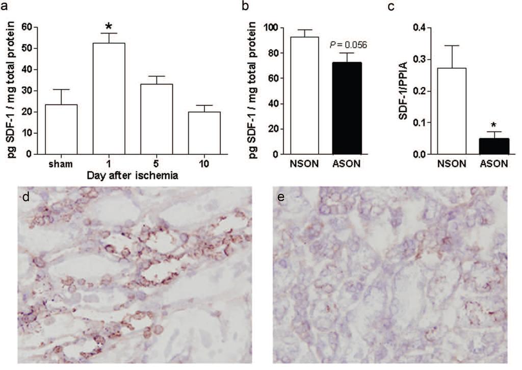 (SDF)-1 καρδιοπροστασία The chemokine SDF-1a, participate in tissue repair by mediating migration of circulating stem or progenitor cells to sites of tissue injury.