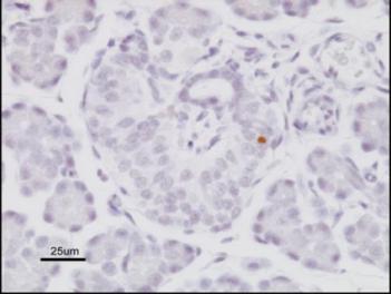 BETA- CELL MASS IN NEONATAL RATS 100