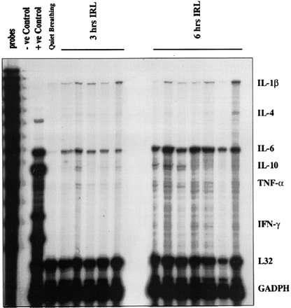 Vassilakopoulos T et al.