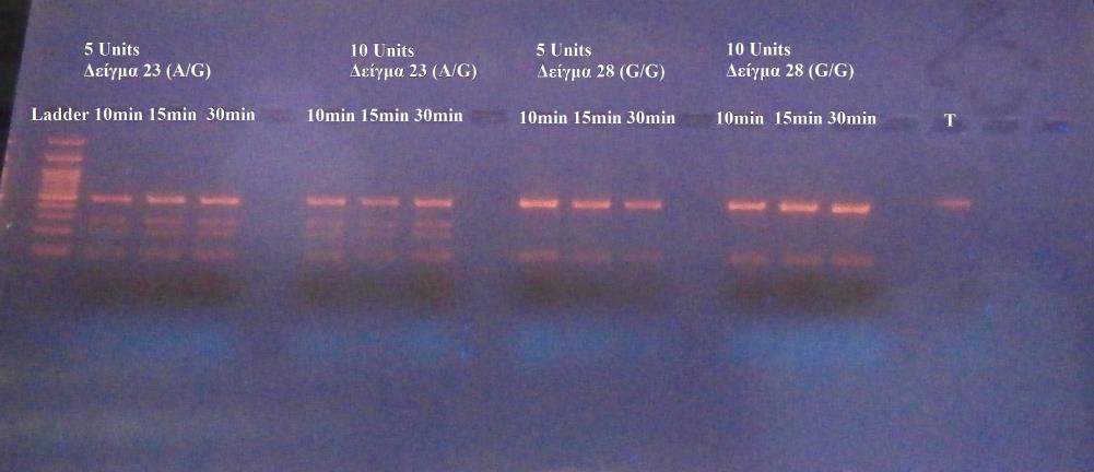 Κατά τη μελέτη αυτή αναλύθηκαν οι πολυμορφισμοί rs7860909 (γονίδιο ASS1), rs944725 και rs1137933 (γονίδιο NOS2A).