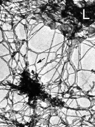 7 ταυτίζεται µε µια µορφή της RNA πολυµεράσης II και ανοσοκατακρηµνίζεται µε σύµπλοκα µατίσµατος του RNA (Mortillaro et al., 1996).