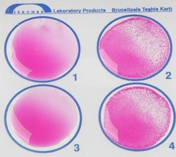 Ανίχνευση συγκολλητινών (IGg1 Abs) έναντι των ειδών του γένους Brucella (B. abortous, B.