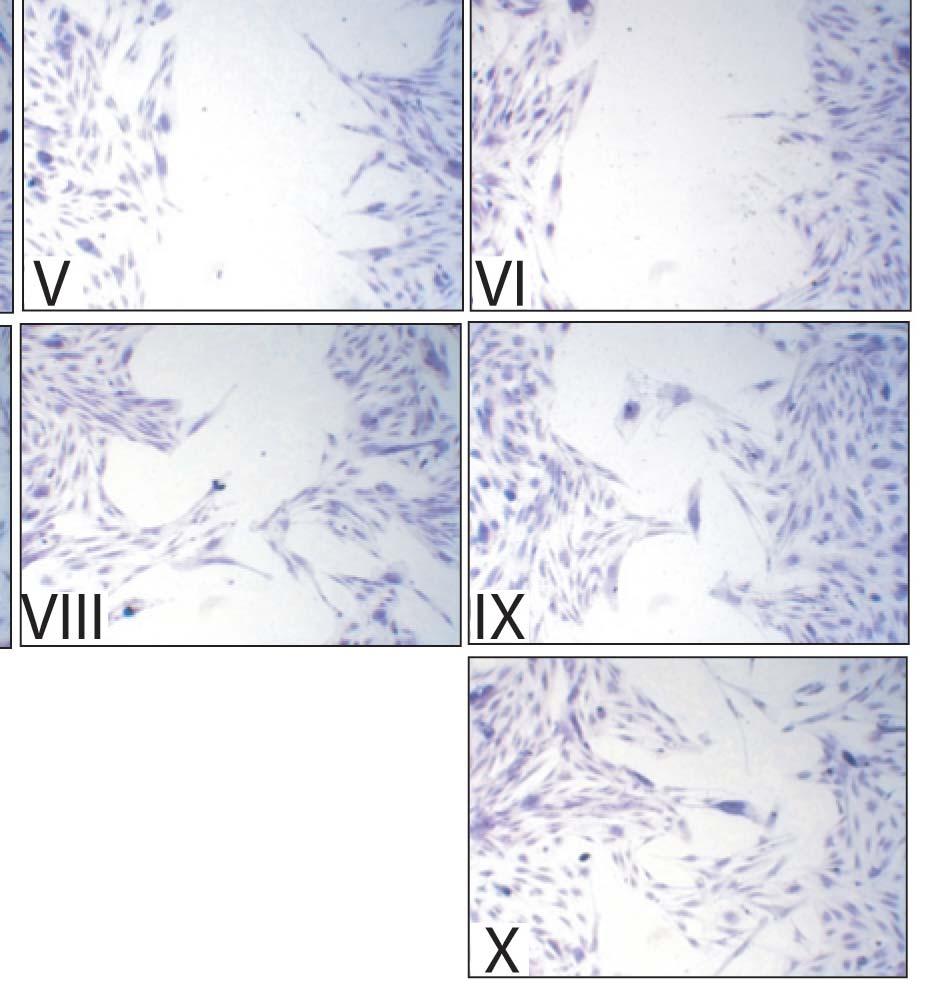 S(V)MCs, Fibroblasts, Myofibroblasts DERIVED TF Produce TF after inflammatory induction Inducers (PDGF,