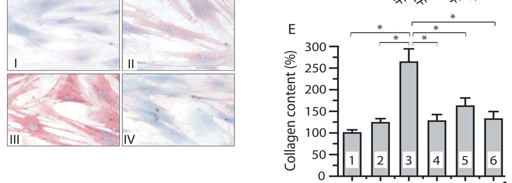 TF mediates intimal hyperplasia and luminal narrowing TF mediates arterial changes by mechanisms not dependent on thrombosis TF/Thrombin driven (PARs) fibrotic