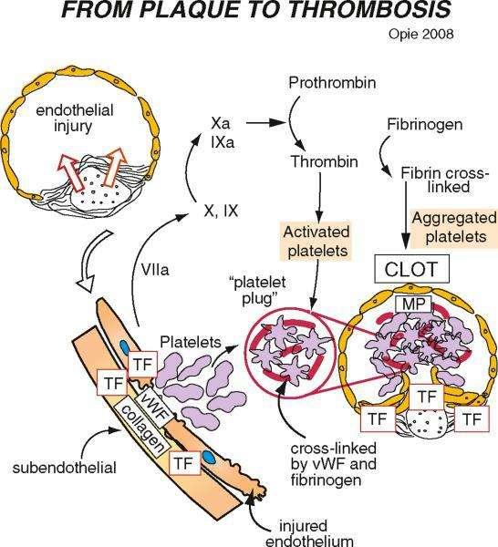 η ή ε η. η ό β ση σ ε ε η (. η έ ε η V Leiden ή ε η (. ε ε σ ή όσ ηση) (Longo et al, 2012).