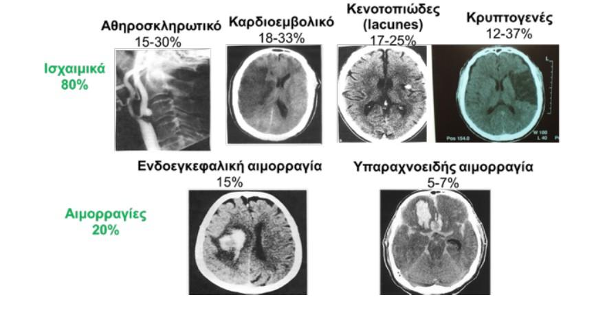 Ταξινόμηση