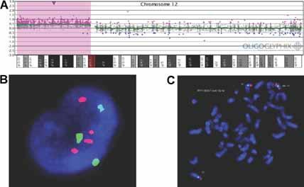 acgh detects partial tetrasomy of 12p in blood from Pallister Killian syndrome cases without invasive skin biopsy American Journal of Medical