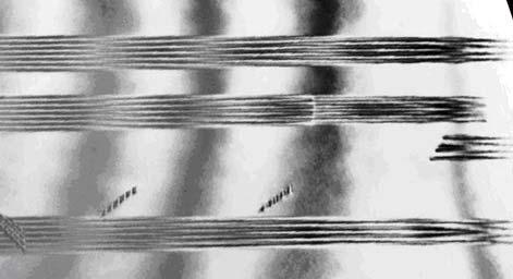 μέθοδοι ανάπτυξης & σφάλματα δομής SiC Σχήμα 1.10: εικόνα PVTEM με σφάλματα επιστοίβασης στο 3C-SiC.