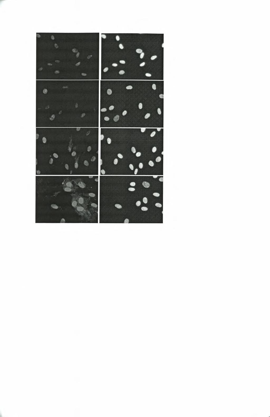 anti-hif-la DAPI Control CoCl2 FBS FBS + CoCl2 Εικ.17 : Ανοσοφθορισμός διαφοροποιημένων ΛΜΚΒ ανθρώπου με μονοκλωνικό αντίσωμα ποντικού κατά του HIF-la.