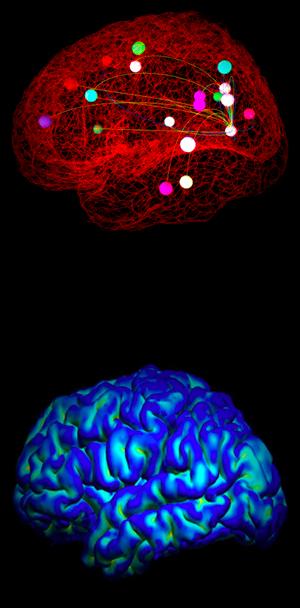 BRAIN RESEARCH Τον Σεπτέμβριο του 2010 το Εθνικό Ινστιτούτο Υγείας επένδυσε $40 εκατομμύρια με τους ερευνητές στο Χάρβαρντ, το Πανεπιστήμιο της Ουάσιγκτον στο Σεντ Λούις, το Πανεπιστήμιο της Μινεσότα
