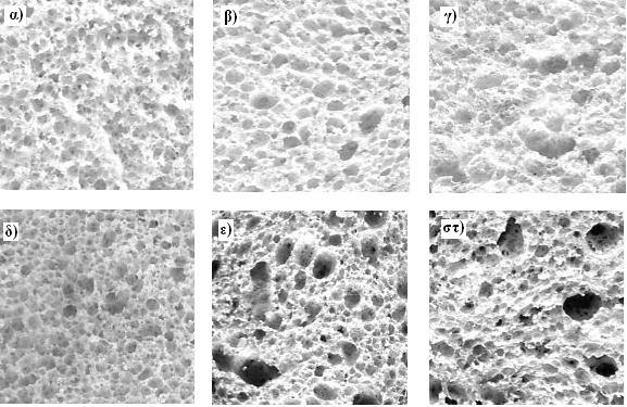 5.2.2 Ανάλυση της εικόνας με το πρόγραμμα UTHSCSA Image Tool Η αρχή της μεθόδου βασίζεται στην εξαγωγή πληροφοριών από τις εικόνες (Σχήμα 44).