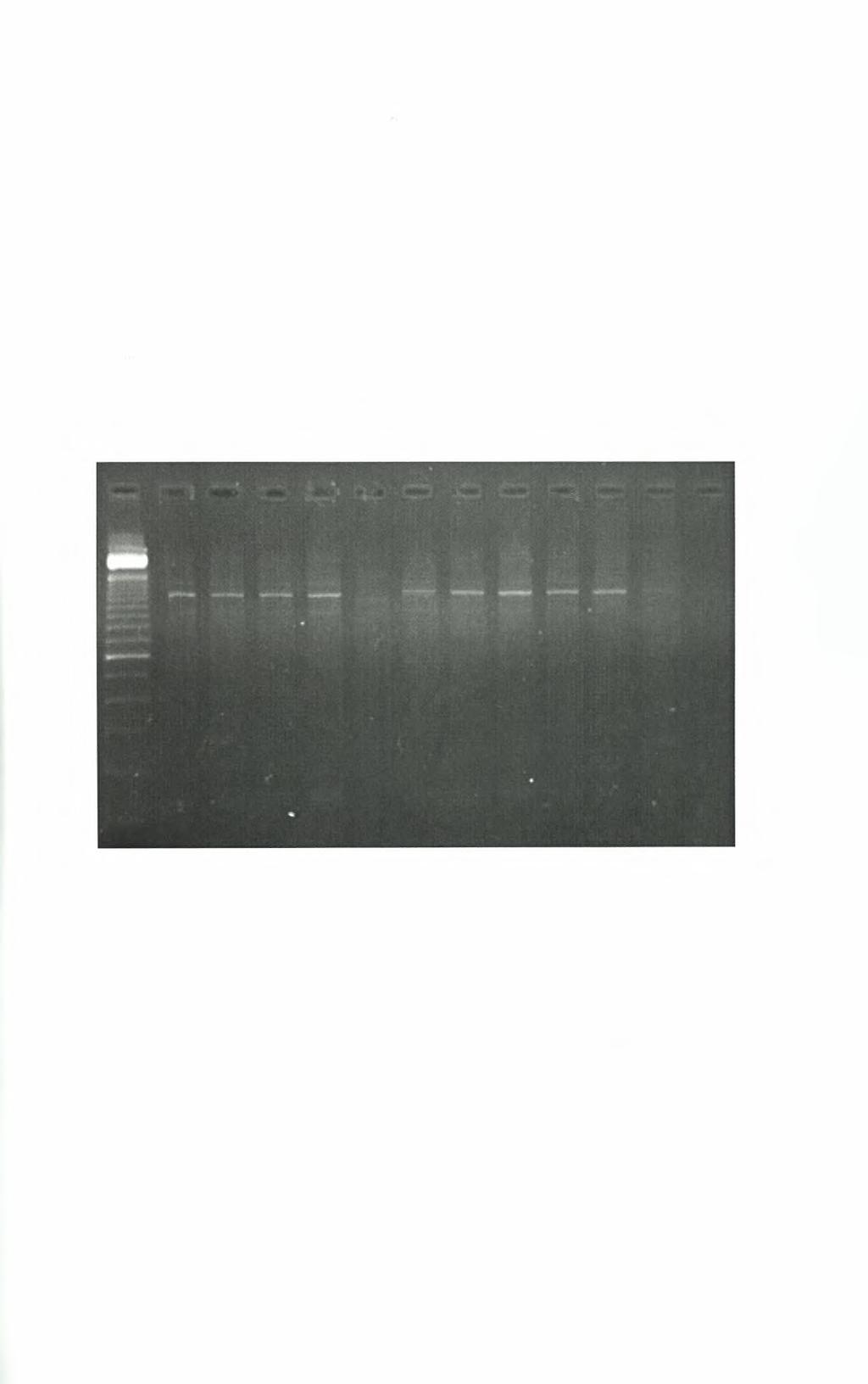 7. Αποτελέσματα 7.1 Αποτελέσματα PCR β-γλοβουλίνης. Στην εικόνα 7.1 παρουσιάζονται τα αποτελέσματα της PCR για την ενίσχυση του γονιδίου της β-γλοβουλίνης εννέα κλινικών δειγμάτων.