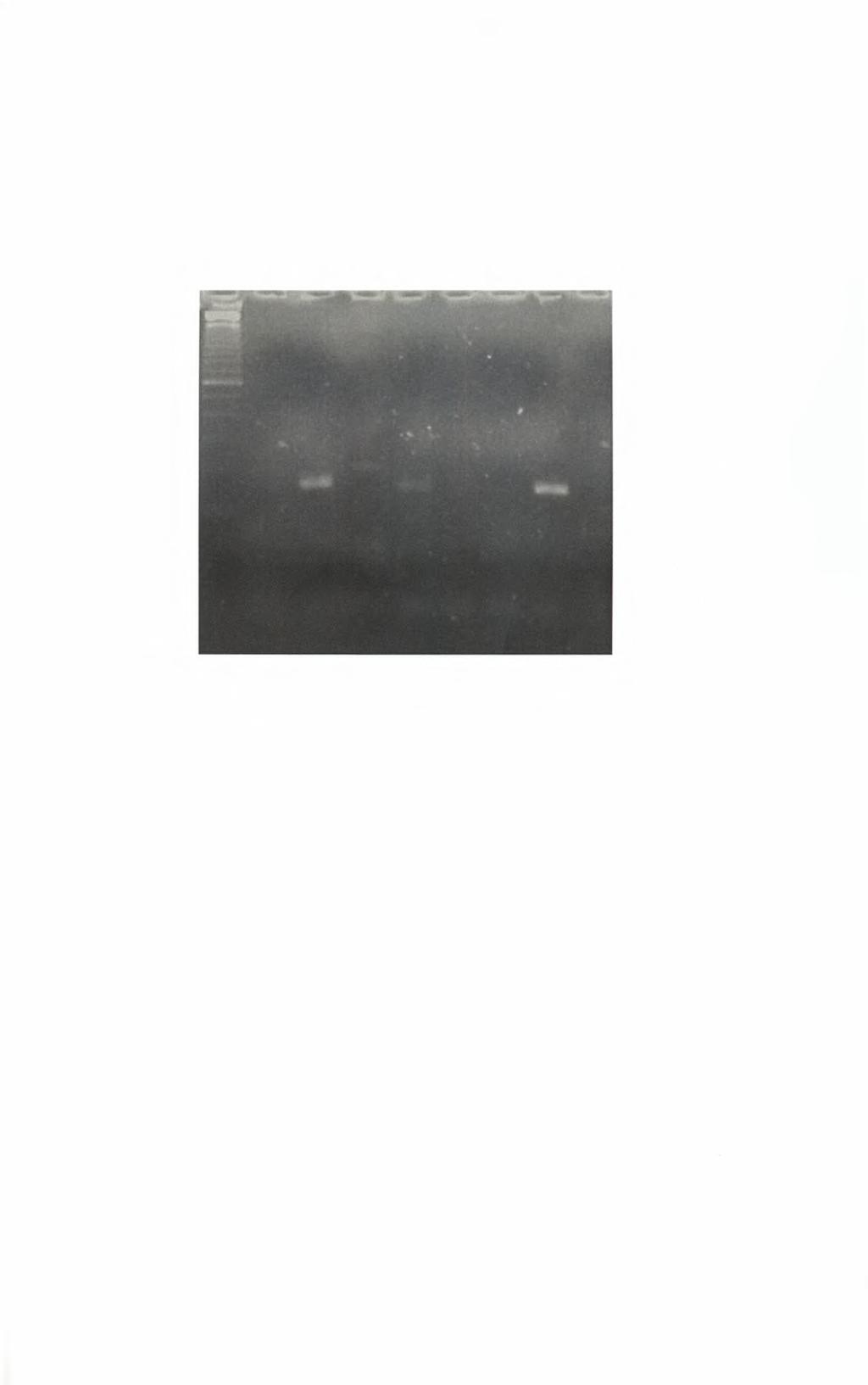 7.4 Αποτελέσματα Nested Multiplex PCR με το τρίτο μείγμα εκκινητικών μορίων. Σύμφωνα με την εικόνα 7.