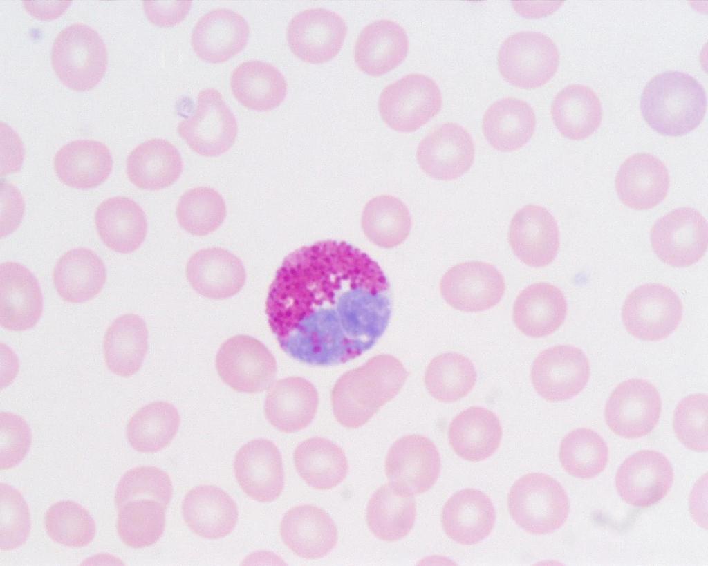 Είδη λευκοκυττάρων του πλάσματος 2/5 Ηωσινόφιλα: Λέγονται έτσι γιατί βάφονται βαθύ κόκκινα με τη χρωστική ηωσίνη.