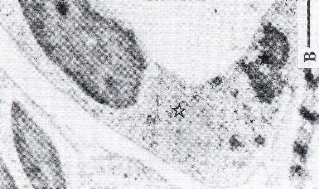 Έγκλειστα ιών-μελών του γένους Caulimovirus (2)