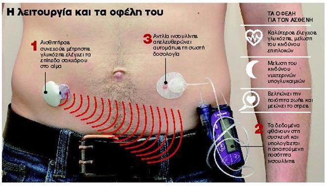 Αδαμαντία Ροδάκη μετρήσεις των διάφορων φυσιολογικών σημάτων του ανθρώπινου οργανισμού[6].