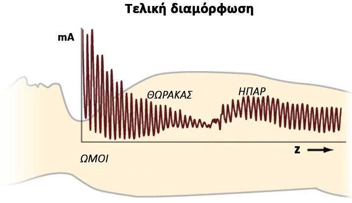 Παράγοντες που επηρεάζουν τη δοσιμετρική συμπεριφορά των αξονικών τομογράφων Τα περισσότερα συστήματα κάνουν ταυτόχρονη χρήση των δύο παραπάνω τεχνικών διαμόρφωσης, με τελικό αποτέλεσμα αντίστοιχο με