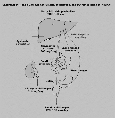 Prekomerno nastajanje bilirubina Primerjava hiperbilirubinemije pri hemolitični anemiji, hepatitisu in žolčnih kamnih Hemolitična anemija