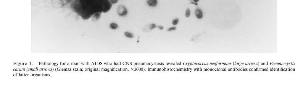 ) IV for 15 days and then orally for 28 days Clinical Infectious Diseases