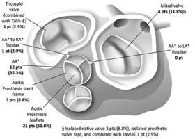 with previous transcatheter aortic