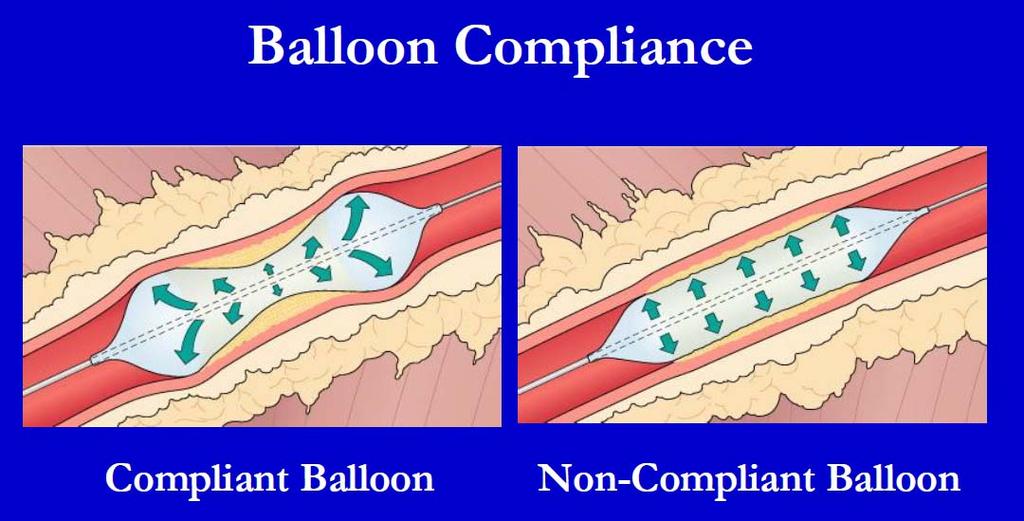 Compliance Compliance: Change in volume per