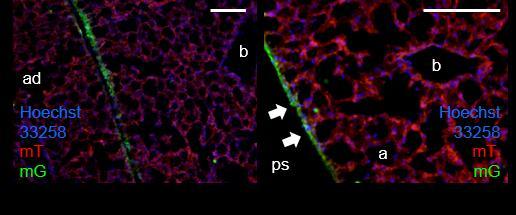 Σχήμα 4.6. Απεικόνιση υπεζωκοτικών επιφανειών mt.mg ποντικών, με τη βοήθεια της μικροσκοπίας φθορισμού, που έλαβαν Αd-Cre σε μεγαλύτερη μεγέθυνση. 4.1.