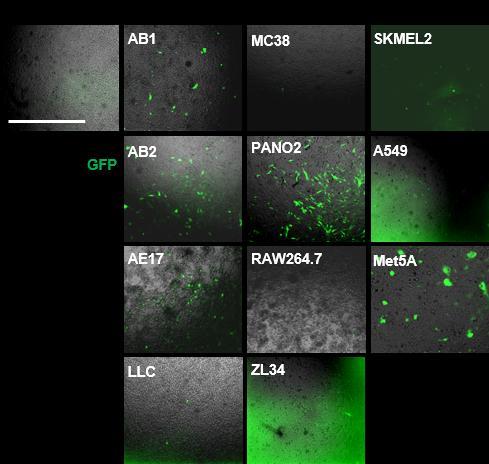 Σχήμα 4.12. Απεικόνιση με τη βοήθεια της μικροσκοπίας φθορισμού των κυτταρικών σειρών στις 0,24, 48, 72 ώρες μετά τη διαμόλυνσή τους τους με Ad-Luc και Ad-GFP.