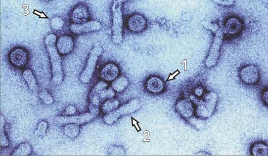 Vírus Hepatitídy B čeľaď Hepadnaviridae, rod Orthohepadnavirus obalený ds/ss DNA vírus, na replikáciu využíva reverznú