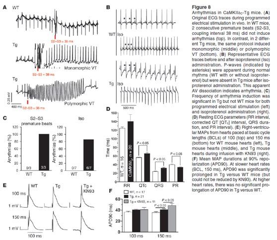 Electrophysiological Changes Oxidative stress, CaMKII, I Na