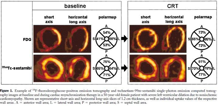 Regional Transcriptome CRT restores homogeneous