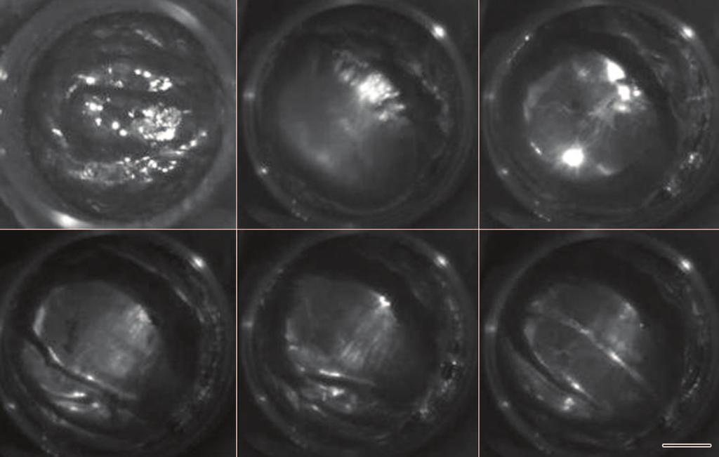 Ù 8 «Ó Ð : ÃÈ¾Ø Ñ Â Æ 123 ² 9 ³É É± ± Ò Fig.9 Photos of the fluctuation behavior of the melt surface under compound field with different static magnetic flux densities (f=23 khz, B a =.