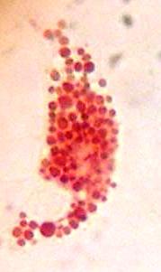 ΥΛΙΚΑ ΚΑΙ ΜΕΘΟΔΟΙ L N Εικόνα 13. Αντιπροσωπευτικό δείγμα αιμοκυττάρων με χρώση ουδέτερου ερυθρού (μεγέθυνση 1000x). Ν: πυρήνας, L: λυσοσώματα.