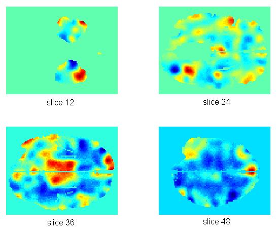 Παράδειγμα: fmri