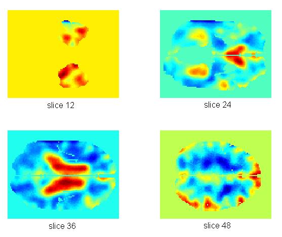 (contrast maps)