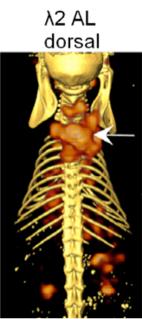 binds amyloid fibrils composed of