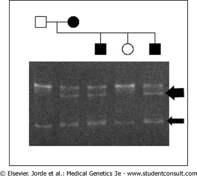 για να συνθέσει συμπληρωματικό DNA πλαισίου ανάγνωσης, (cdna) με RT-PCR με 5 εκκινητή που περιοχής ματίσματος, ή περιέχει τον υποκινητή του γονίδιου ανερμηνεύσιμων T7, το DNA μεταφράζeται και το