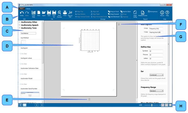 5 Πλοήγηση στο OTOsuite REPORTS A. Menu bar (Γραμμή μενού) B. Toolbar (Γραμμή εργαλείων) C. Πλαίσιο στοιχείων αναφορών D. Σελίδα Αναφοράς E. Δημιουργία επόμενης σελίδας στο πρότυπο F.