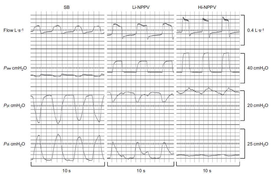 ΜΕΜΑ και αναπνευστικοί μύες Lukácsovits J, et al.