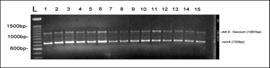 - ddl E. faecium (1091bp) - vana (732 bp) Εικόνα 5.6. Κλινικά VREF στελέχη. Σειρές 1-15: E. faecium vana Πίνακας 5.1. Επιπολασμός των VRE στελεχών Προέλευση Αριθμός δειγμάτων Αρ.