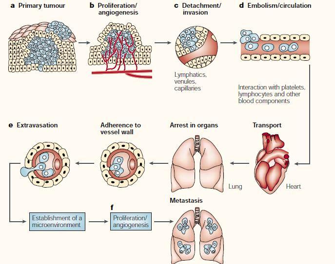διαμόρφωση τους είναι ευνοϊκή για εμφύτευση νεοπλασματικών κυττάρων προσερχομένων με το αίμα[32]. Εικόνα 2: Τα κύρια στάδια της μετάστασης στον πνεύμονα. a. Αύξηση του πρωτοπαθούς όγκου, b.