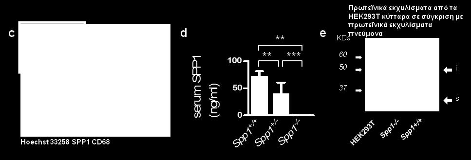 μακροφάγα εξέφραζαν ταυτόχρονα CD68 και SPP1. d.