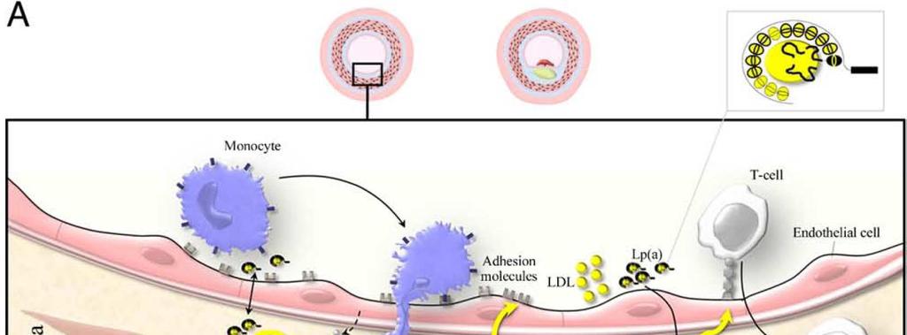 Lp(a) and pathogenesis of vascular disease via