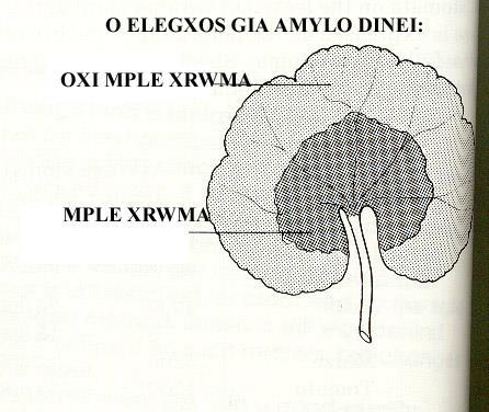 είναι παλιό;;; Το μπλε του αμύλου είναι αχνό: τι θα μπορούσα να είχα κάνει για πιο έντονο;;; - μήπως να «παίξω» στο 2ο βήμα με το χρόνο μου;;; Τι συμπέρασμα βγάζω για