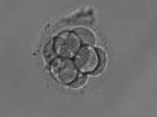 Έμβρυο ωοειδούς σχήματος, αποτελούμενο από 7 κύτταρα