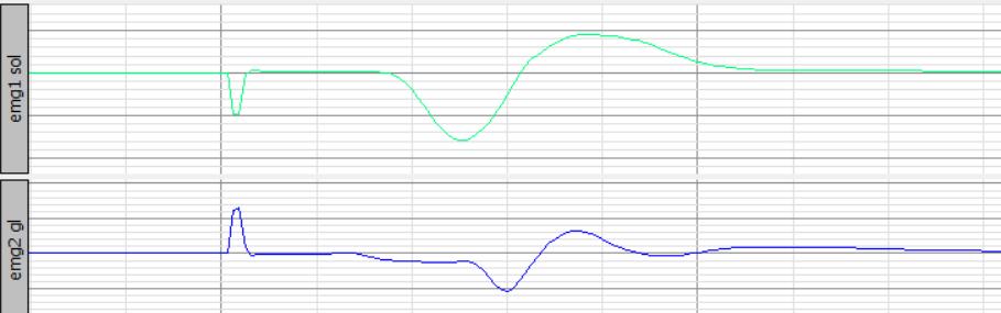 (emg gas τέταρτη σειρά), αλλά και της γωνίας κατά τη διάρκεια του ερεθισμού. Στην τελευταία σειρά βρίσκεται η ροπή φιλτραρισμένη. Γράφημα 4: Μέγιστο Μ-κύμα μετά από ηλεκτρική διέγερση.