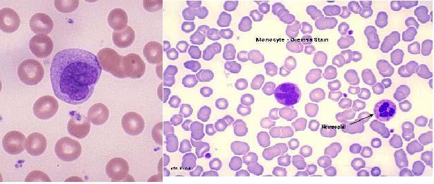 ΕΙΣΑΓΩΓΗ Εικόνα 4. Ανθρώπινα μονοκύτταρα όπως φαίνονται σε μικροσκόπιο με χρώση Giemsa. Διακρίνεται ο μεγάλος πεταλοειδής πυρήνας τους. Image 4. Human monocytes under the microscope with Giemsa stain.