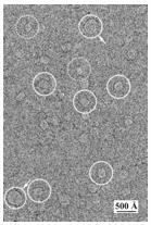 ΕΙΣΑΓΩΓΗ Εικόνα 8. Φωτογραφία ηλεκτρονικού μικροσκοπίου, όπου σε κύκλο φαίνονται οι λιποπρωτεΐνες χαμηλής πυκνότητας στο πλάσμα. Ιmage 8. In the circles are shown the low density lipoproteins (LDL).